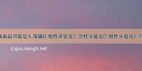 该患者主诉疾病最可能是A.深龋B.慢性鼻窦炎C.急性牙髓炎D.慢性牙髓炎E.可复性牙髓炎