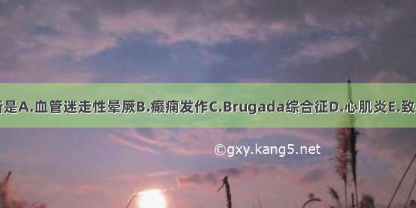 最可能的诊断是A.血管迷走性晕厥B.癫痫发作C.Brugada综合征D.心肌炎E.致心律失常性右