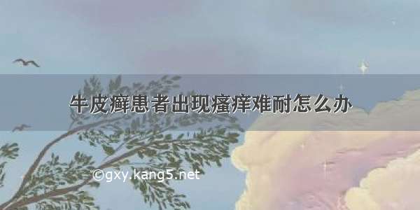 牛皮癣患者出现瘙痒难耐怎么办