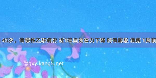 患者男 45岁。有慢性乙肝病史 近1年自觉体力下降 时有腹胀 消瘦 1周前因进食