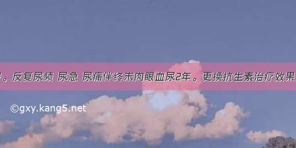 男性 27岁。反复尿频 尿急 尿痛伴终末肉眼血尿2年。更换抗生素治疗效果欠佳 且逐