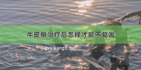 牛皮癣治疗后怎样才能不复发