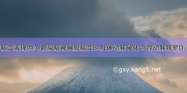 糖尿病微血管病变表现为A.糖尿病视网膜病变B.肢体动脉硬化C.肾动脉狭窄D.出血性脑血管