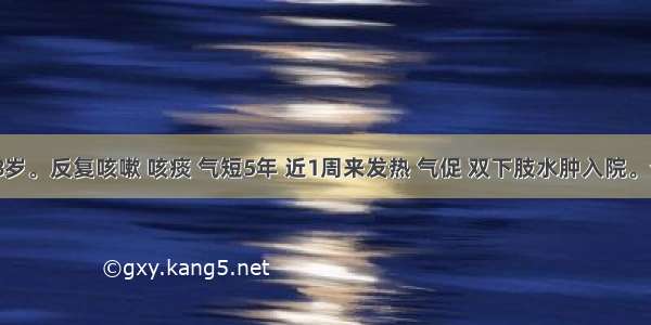 女 58岁。反复咳嗽 咳痰 气短5年 近1周来发热 气促 双下肢水肿入院。查体：