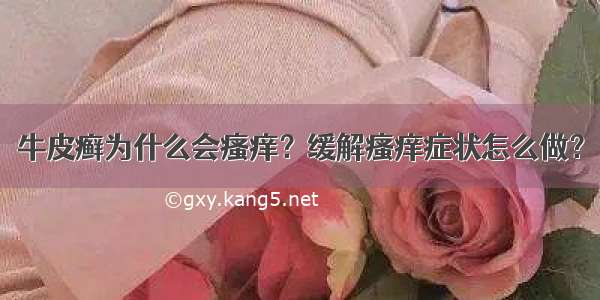 牛皮癣为什么会瘙痒？缓解瘙痒症状怎么做？