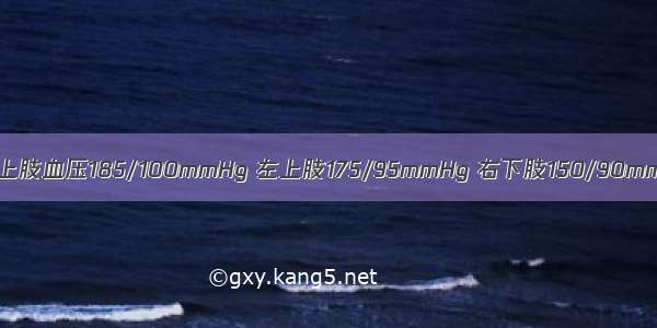 女性。20岁。右上肢血压185/100mmHg 左上肢175/95mmHg 右下肢150/90mmHg 左下肢145