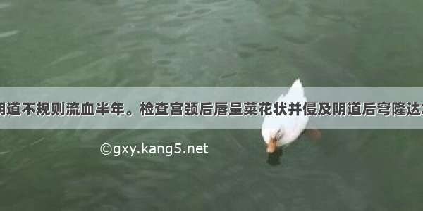 46岁妇女 阴道不规则流血半年。检查宫颈后唇呈菜花状并侵及阴道后穹隆达2cm 子宫正