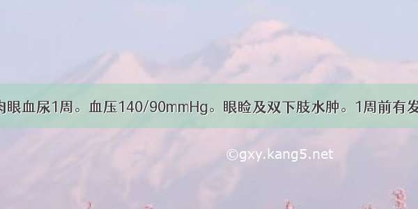 男性 15岁。肉眼血尿1周。血压140/90mmHg。眼睑及双下肢水肿。1周前有发热 咽痛。尿