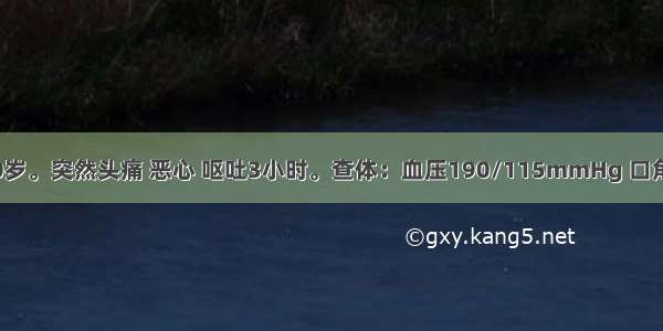 患者 男 60岁。突然头痛 恶心 呕吐3小时。查体：血压190/115mmHg 口角右偏 左侧