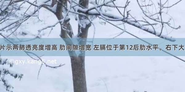 胸部X线摄片示两肺透亮度增高 肋间隙增宽 左膈位于第12后肋水平。右下大片胸膜增厚