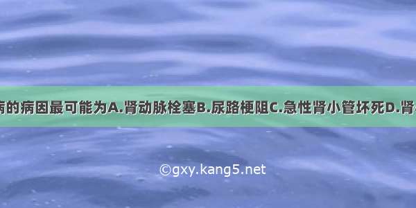 该患者患此病的病因最可能为A.肾动脉栓塞B.尿路梗阻C.急性肾小管坏死D.肾小球疾病E.心