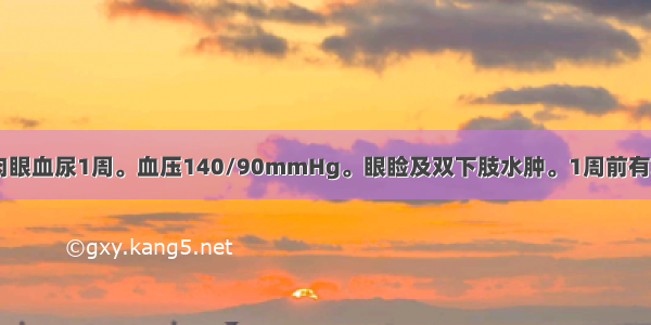 男性 15岁。肉眼血尿1周。血压140/90mmHg。眼睑及双下肢水肿。1周前有发热 咽痛。尿